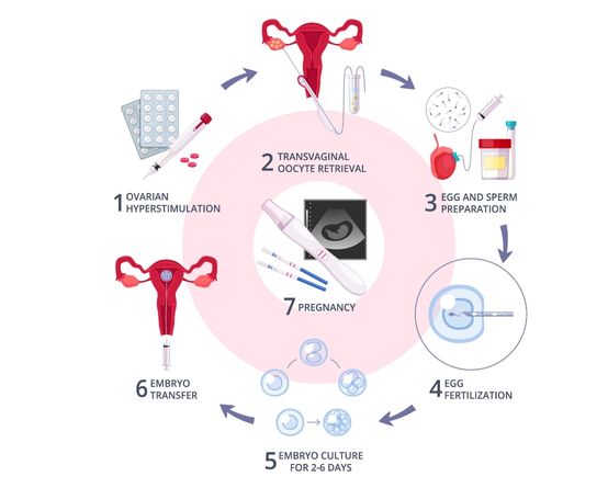 process of IVF