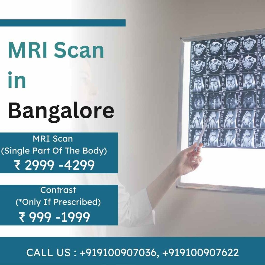 MRI Scan In Bangalore