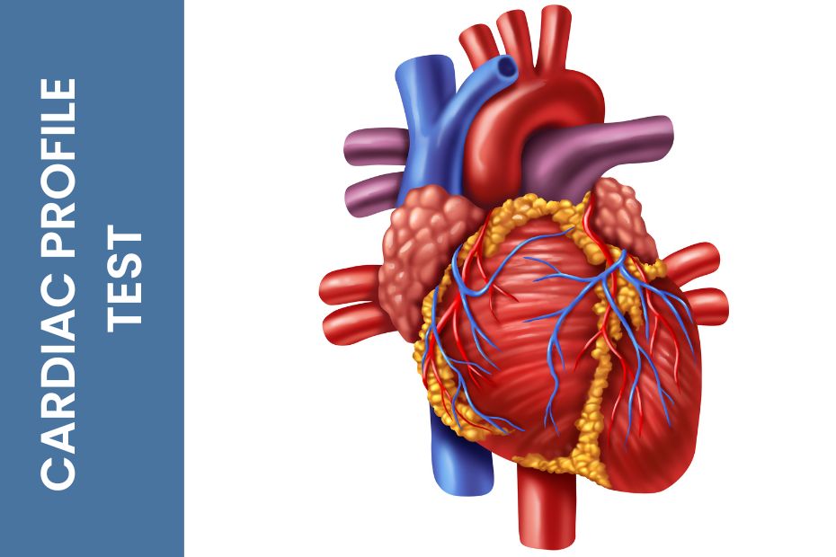 Cardiac Profiles Test Heart Test Medintu