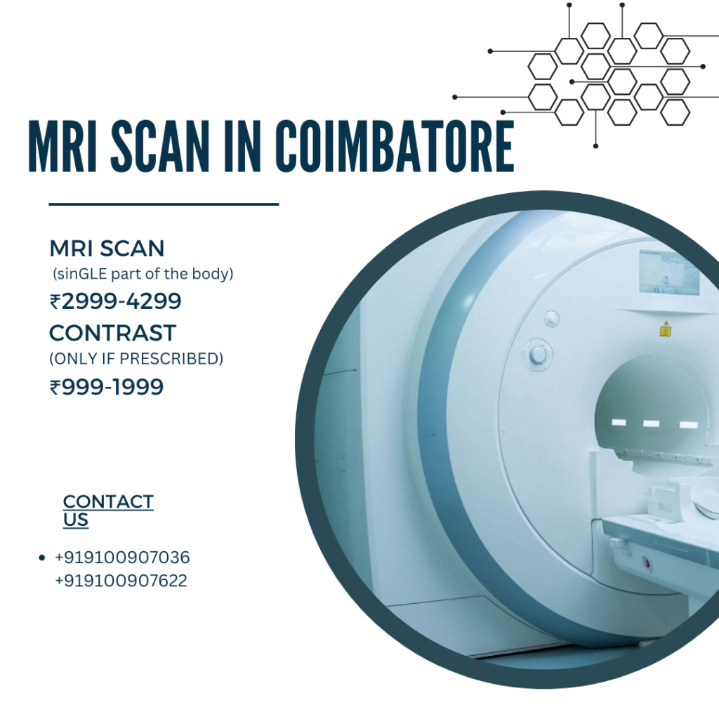 MRI SCAN