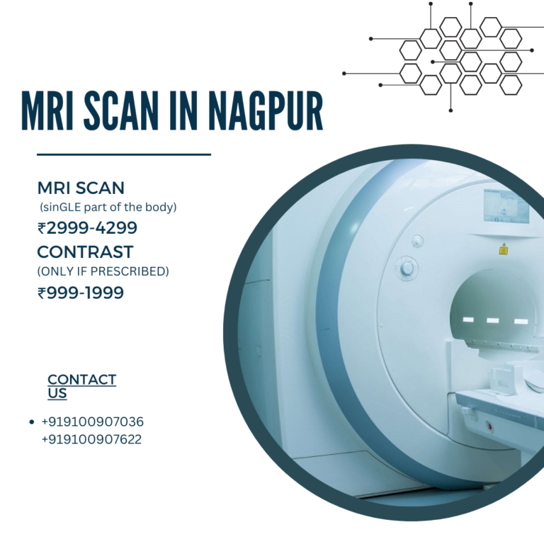 MRI Scan in Nagpur | 50% off | Medintu