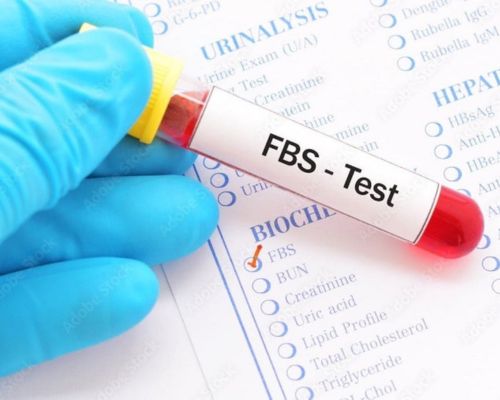 FBS Test Procedure