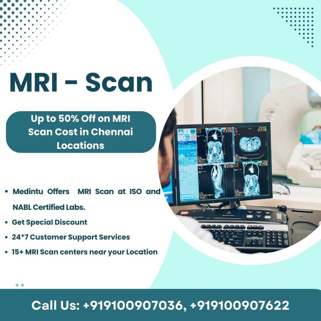 MRI Scan in Chennai Locations