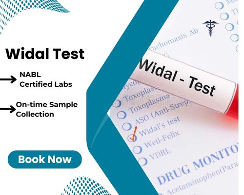 Widal Test cost