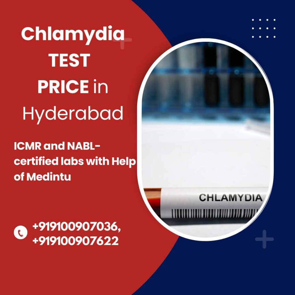 Chlamydia test