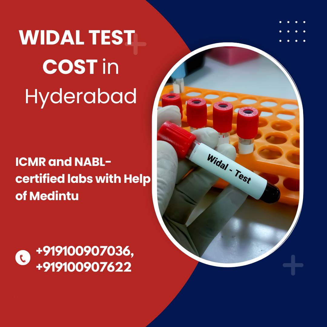 Widal Test In Hyderabad Medintu widal-test-in-hyderabad-medintu