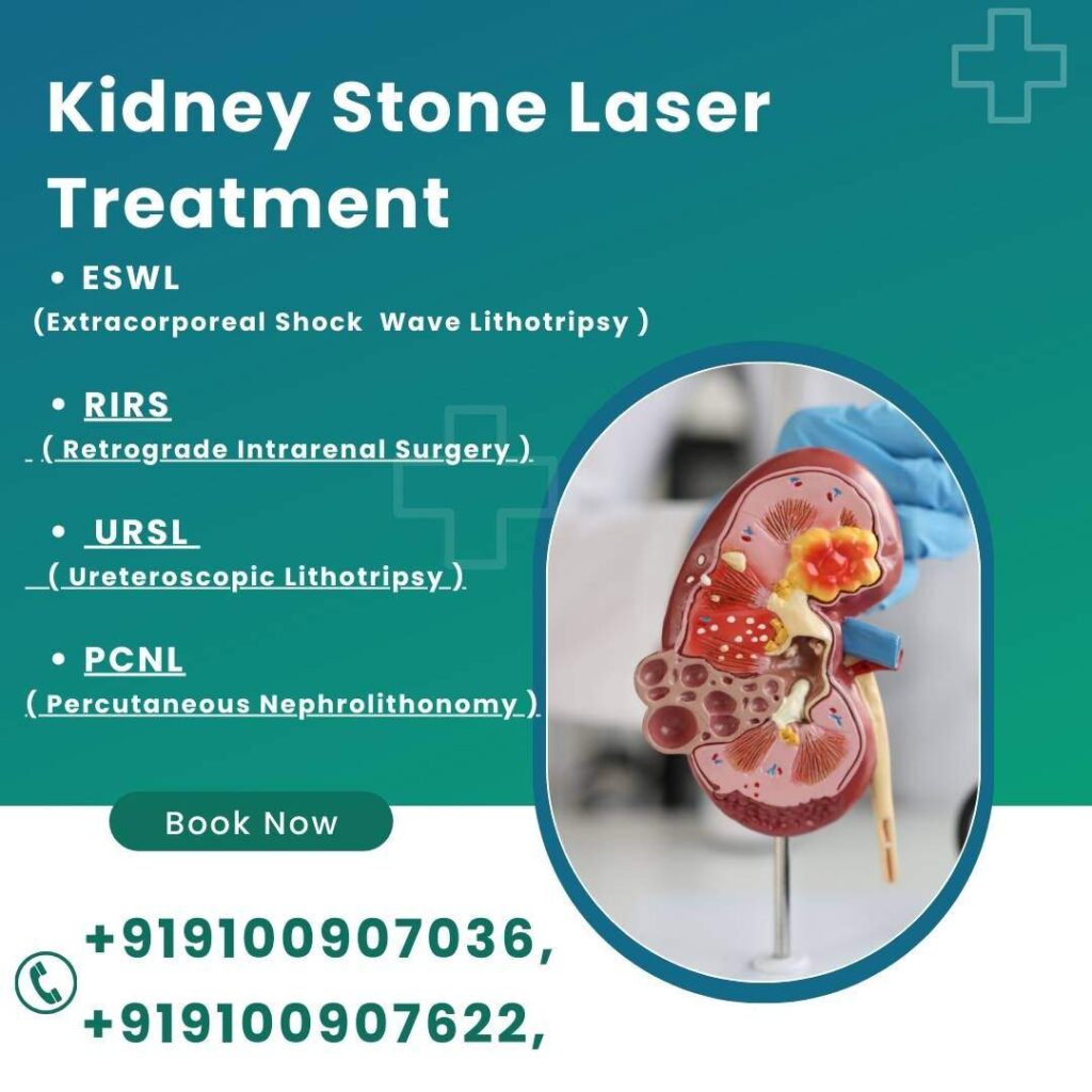 Kidney Stone Laser Treatment