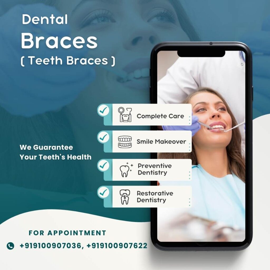 Correcting Teeth with Dental Braces : Type, Cost & Procedure in Bangalore