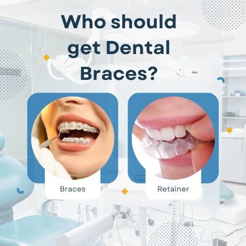 Correcting Teeth with Dental Braces : Type, Cost & Procedure in Bangalore