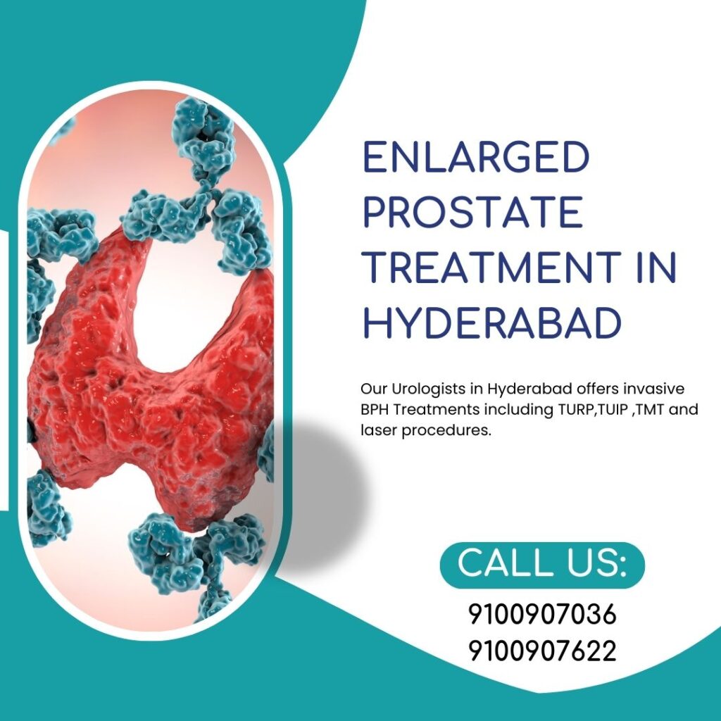 Enlarged Prostate Ttreatment in Hyderabad