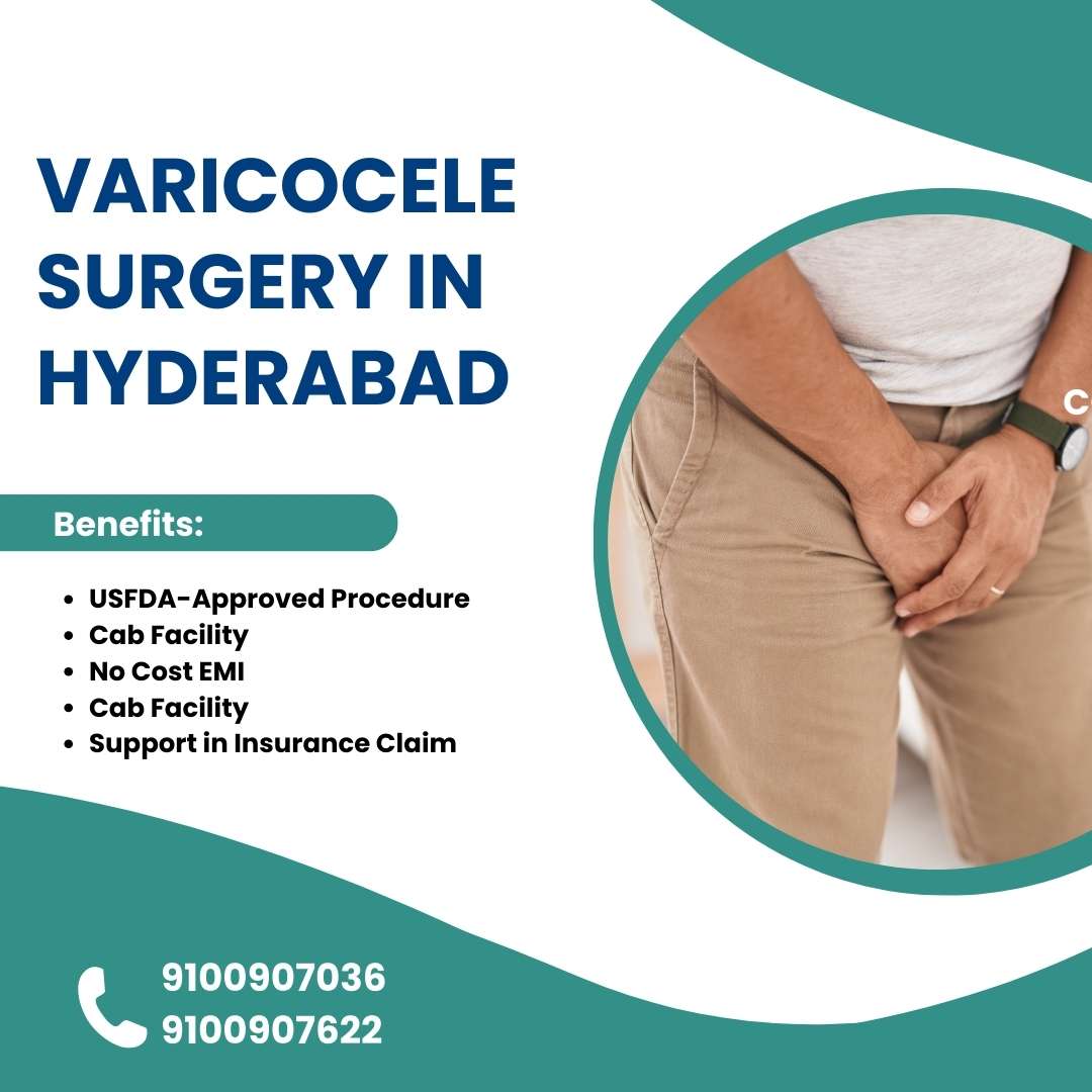 Varicocele surgery in hyderabad