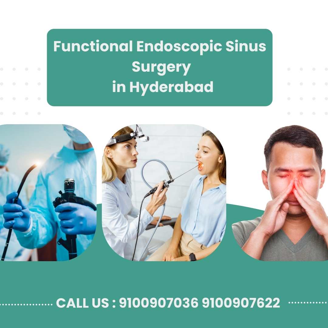 Fess Surgery In Hyderabad