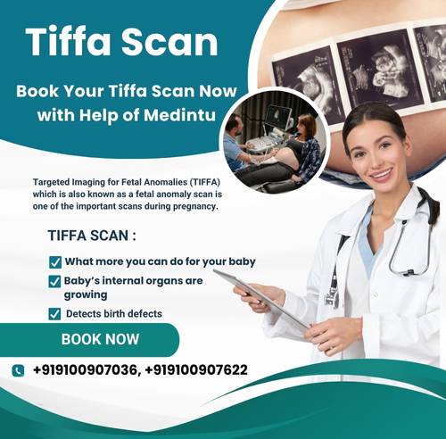 Tiffa Scan