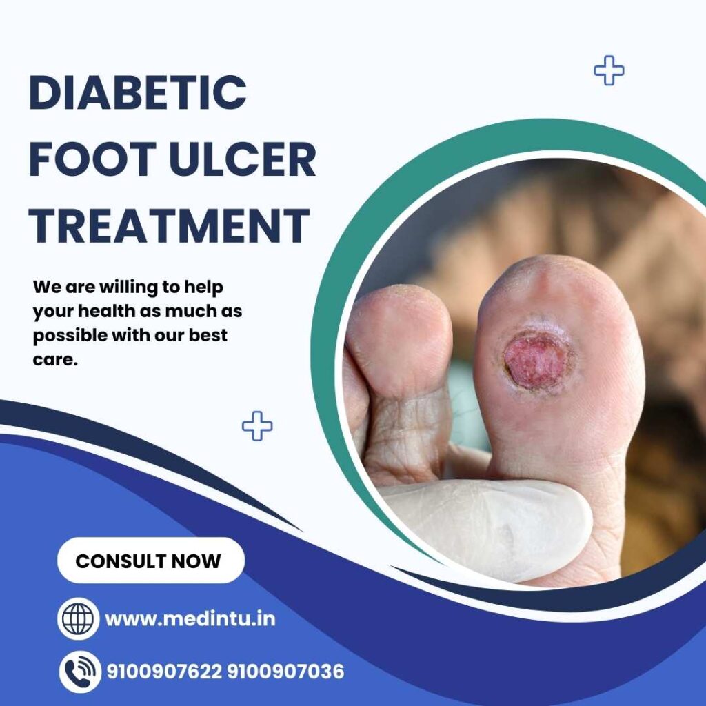 Diabetic Foot Ulcer Treatment   Lowest Price   Medintu