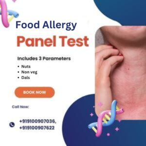 Food allergy panel test