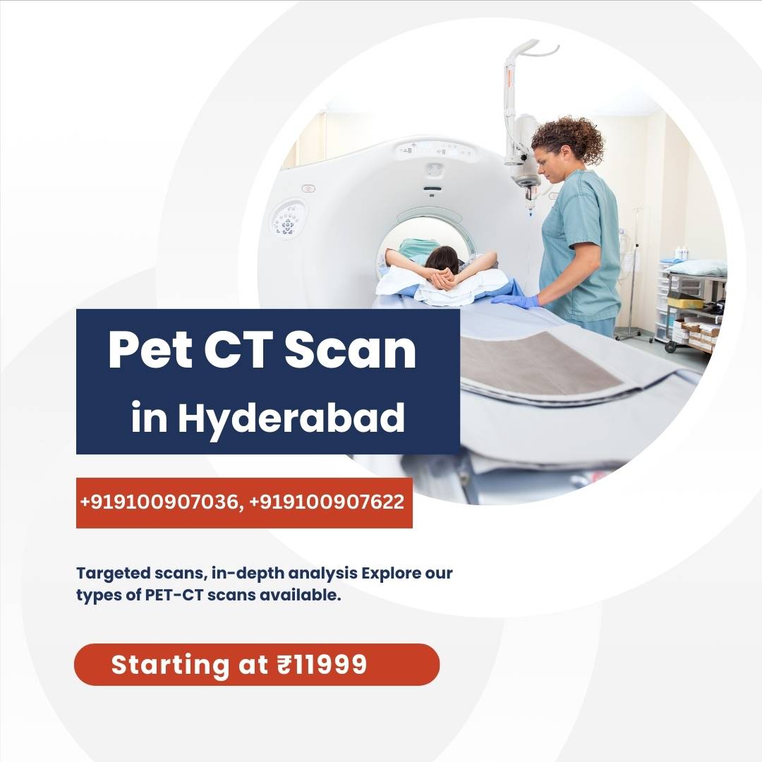 PET CT Scan in Hyderabad