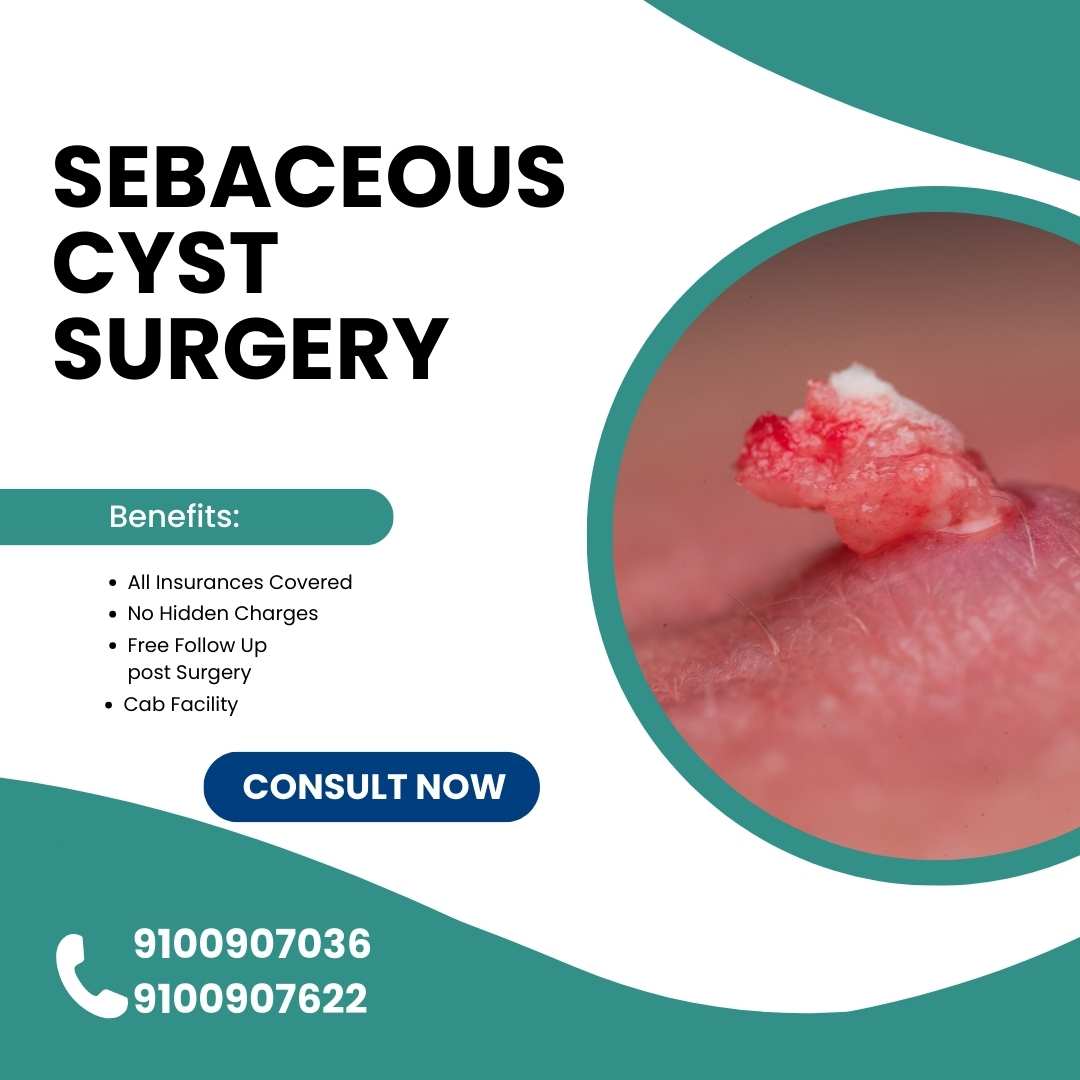 Sebaceous Cyst Surgery | Experienced Doctors | Medintu