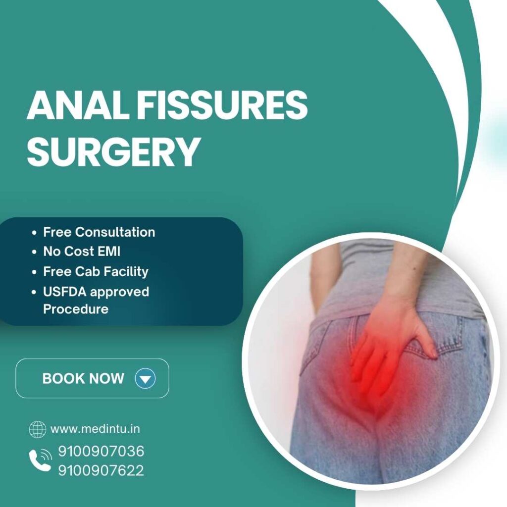 Anal Fissure Surgery in Hyderabad | Treatment & Cost | Medintu