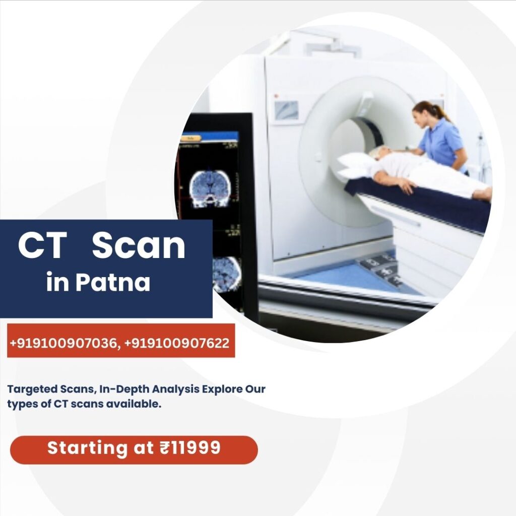 CT Scan in Patna