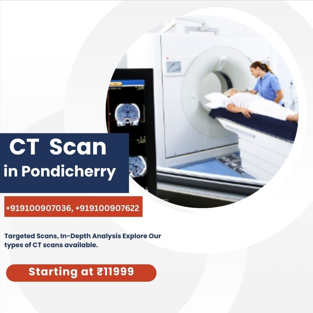 CT Scan in Pondicherry