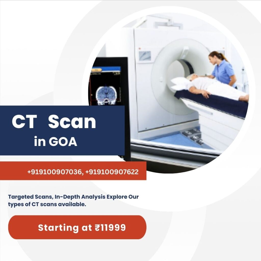 CT Scan in Goa