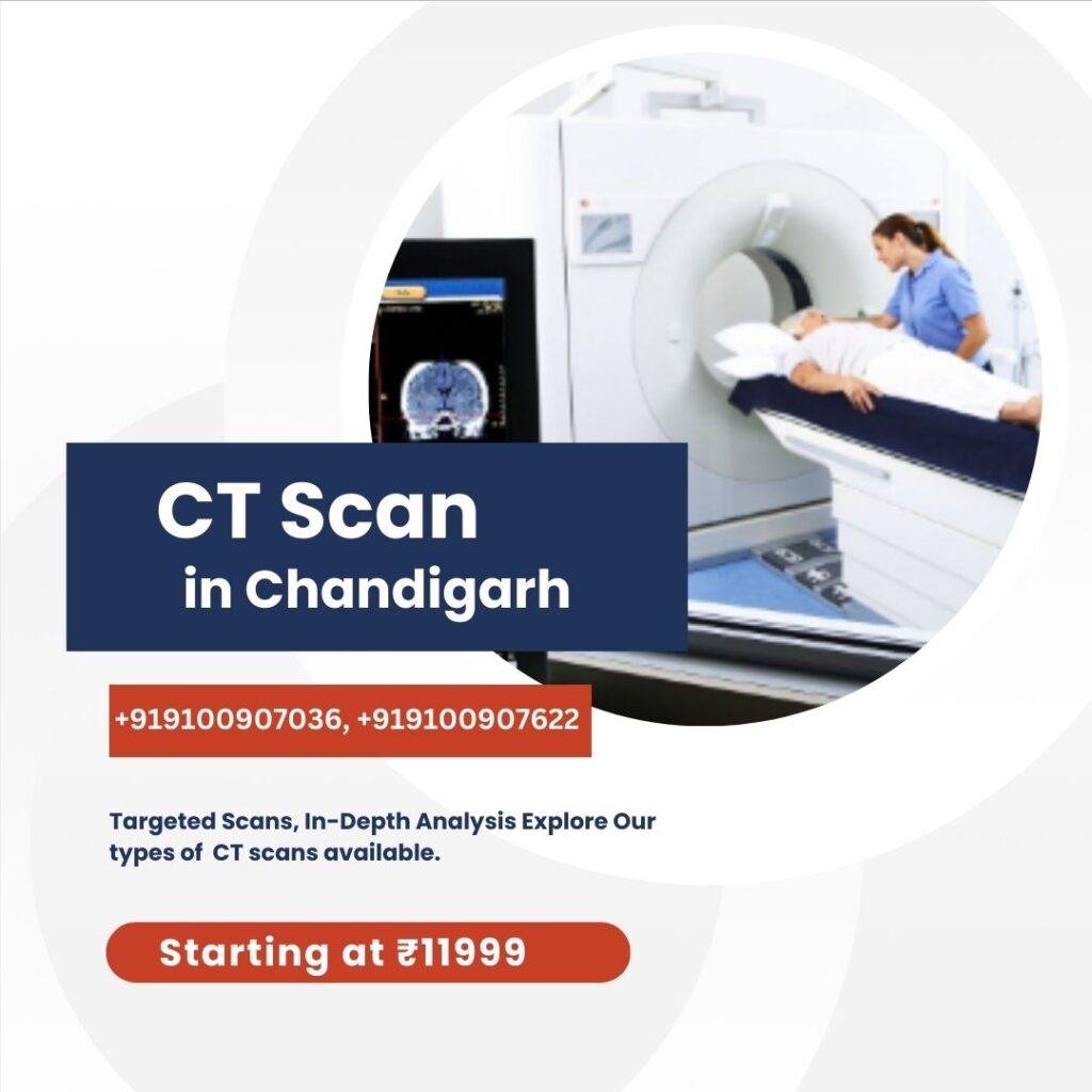 CT Scan in Chandigarh