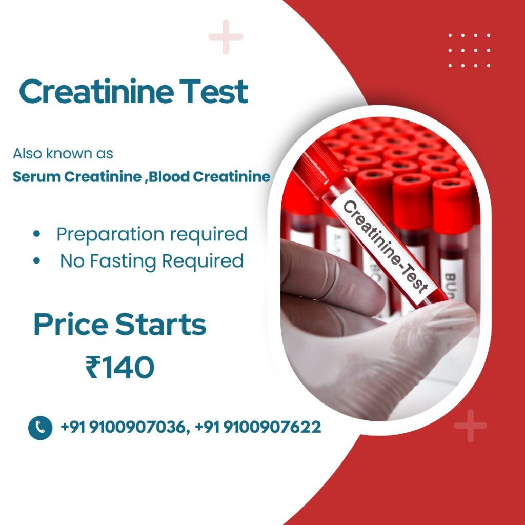 Creatinine Test   Medintu