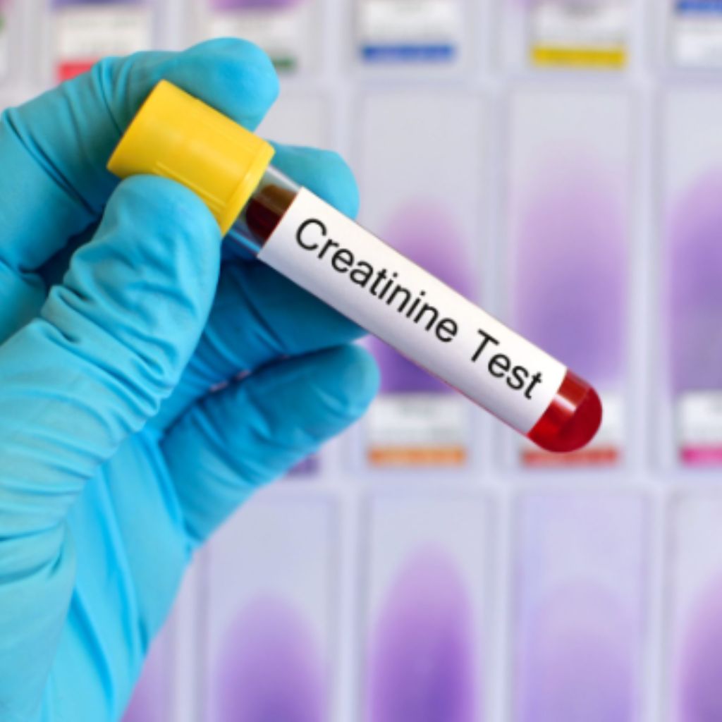 Creatinine test