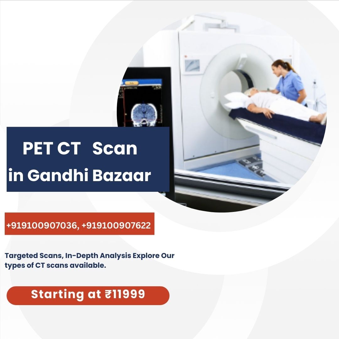 PET CT Scan at Gandhi Bazaar | Bangalore | Medintu