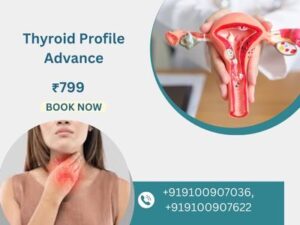 Thyroid profile advance