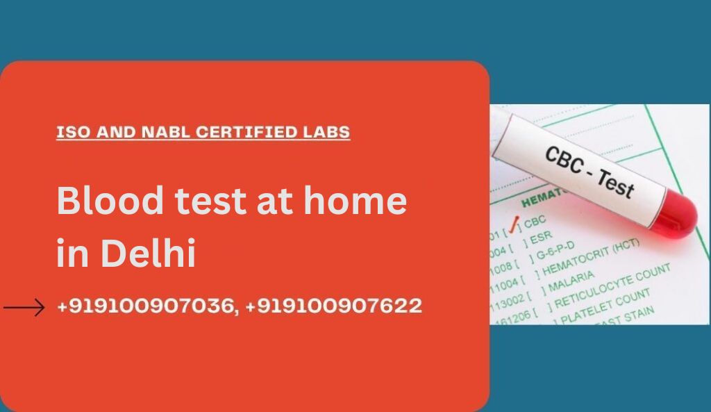 Blood test at home in Delhi