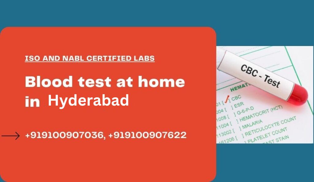 Blood test at home in hyderabad