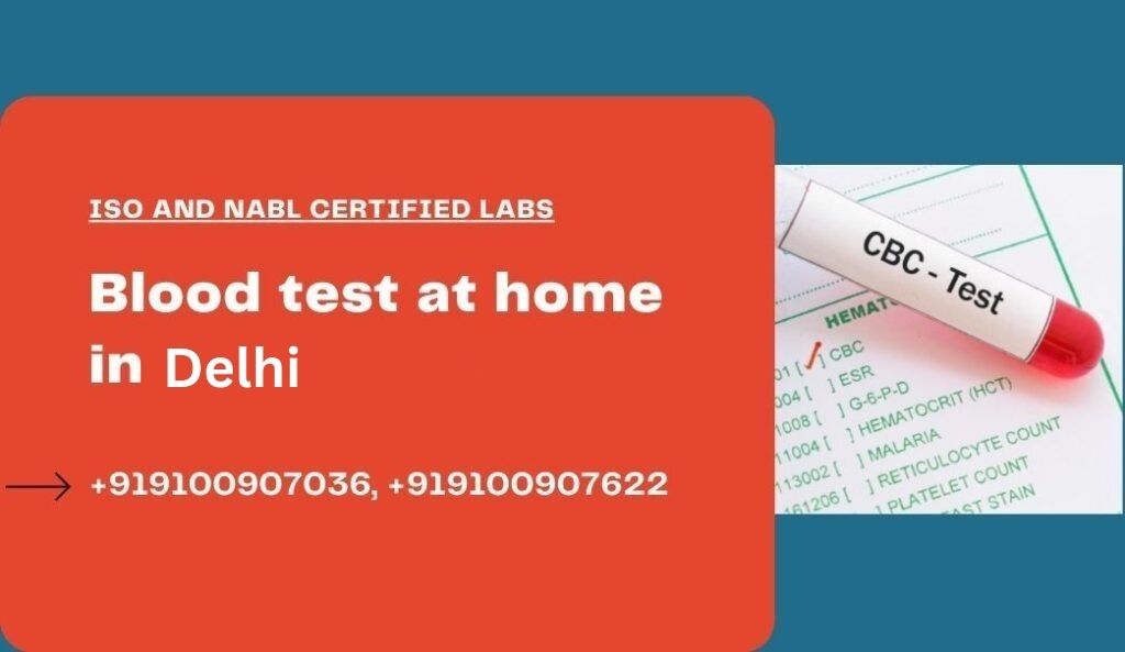 Blood test at home in Delhi