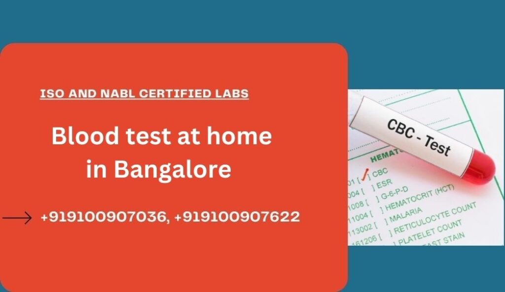 Blood Test At Home In Jayanagar Medintu