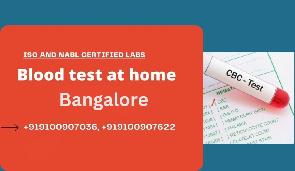 blood test at home in Bangalore