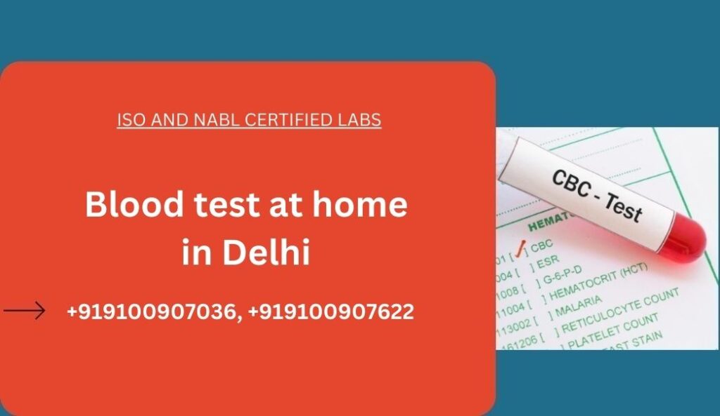 Blood test at home in Delhi