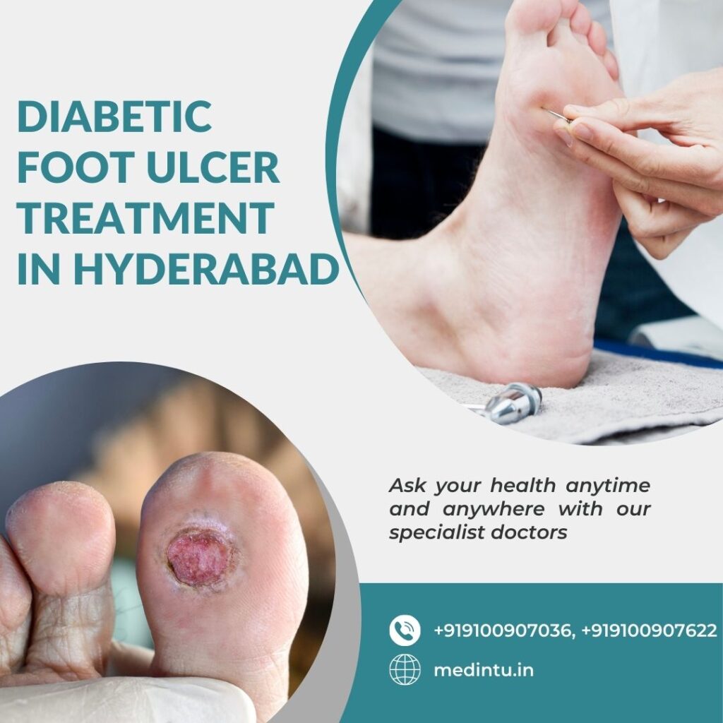 Diabetic Foot Ulcer Treatment In Hyderabad