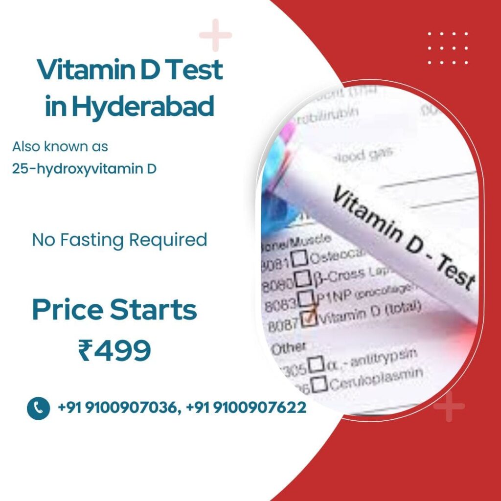 Vitamin D test in Hyderabad