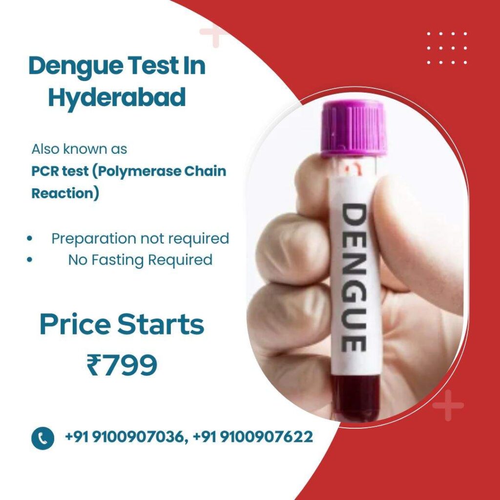 Dengue NS1 Antigen Test At Home In Hyderabad