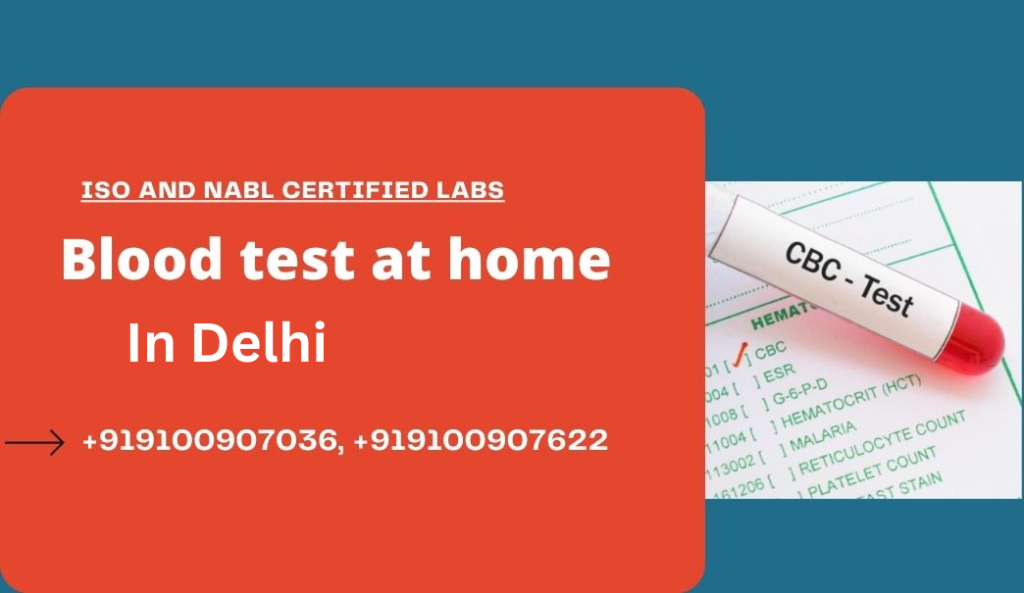 Blood test in Delhi