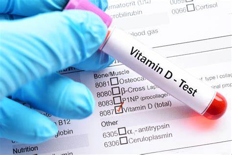 Vitamin-D Test