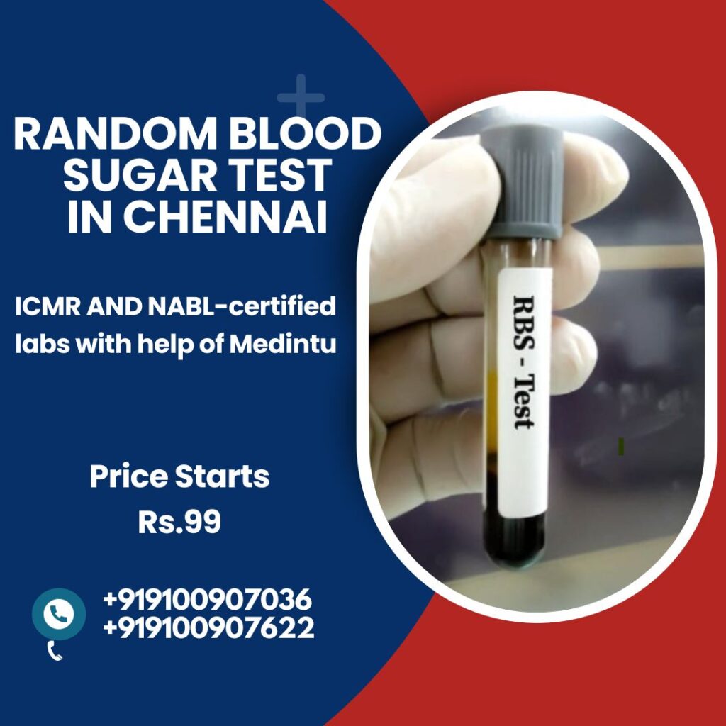 Random Blood Sugar Test in Chennai   Medintu