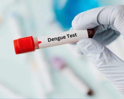 Dengue test