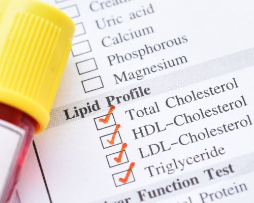 Lipid profile test in Hyderabad