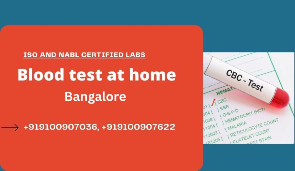 Blood test at home in Bangalore