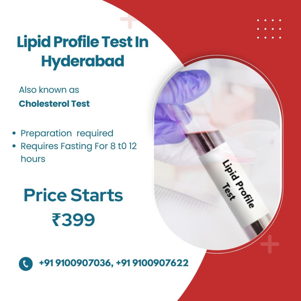 Lipid Test in Hyderabad