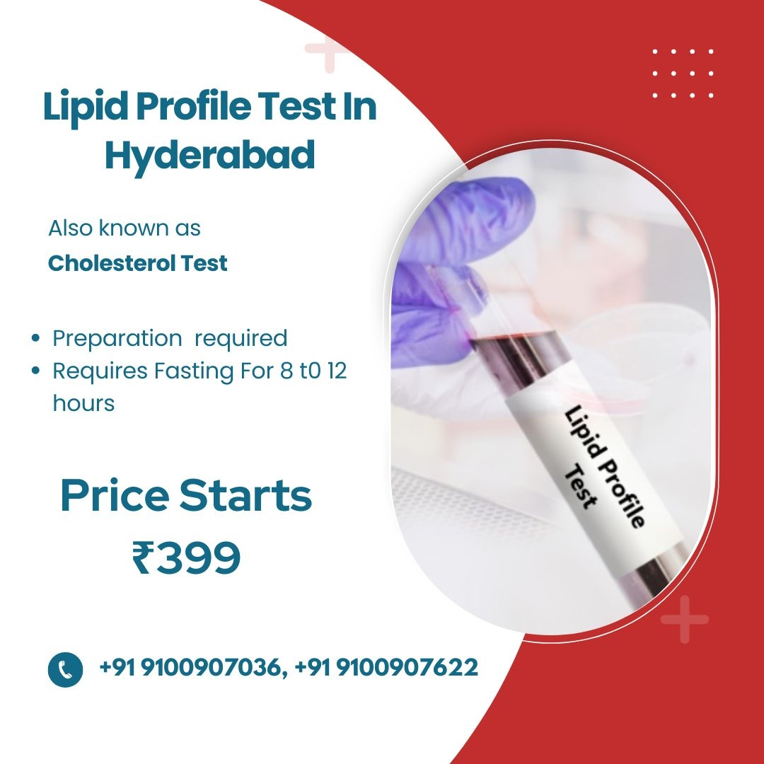 Lipid Profile Test at home in Hyderabad   Rs.20