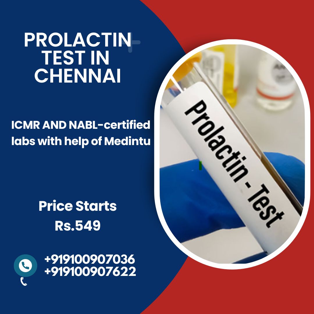 prolactin test in chennai