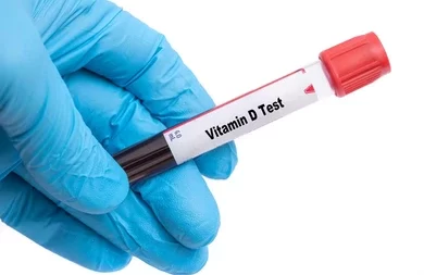 Vitamin D Test