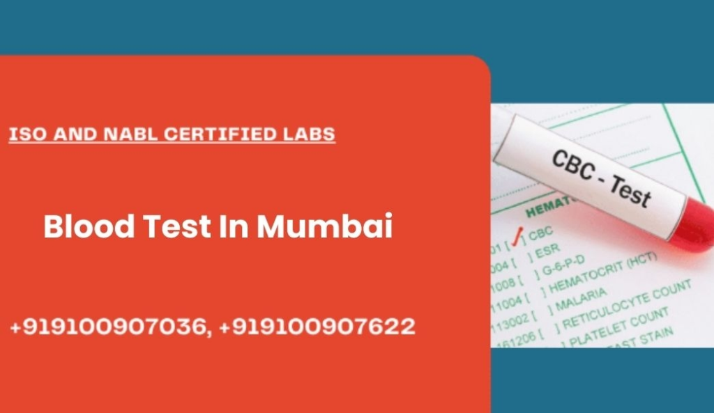 Blood test at home in Mumbai